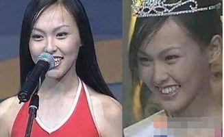 龅牙娱乐吃瓜,揭秘娱乐圈吃瓜背后的真相与笑料